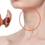 Изменение работы щитовидной железы