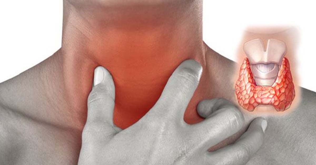 Дисфункции щитовидной железы