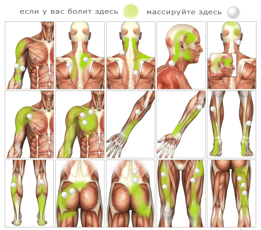 мышцы и боль