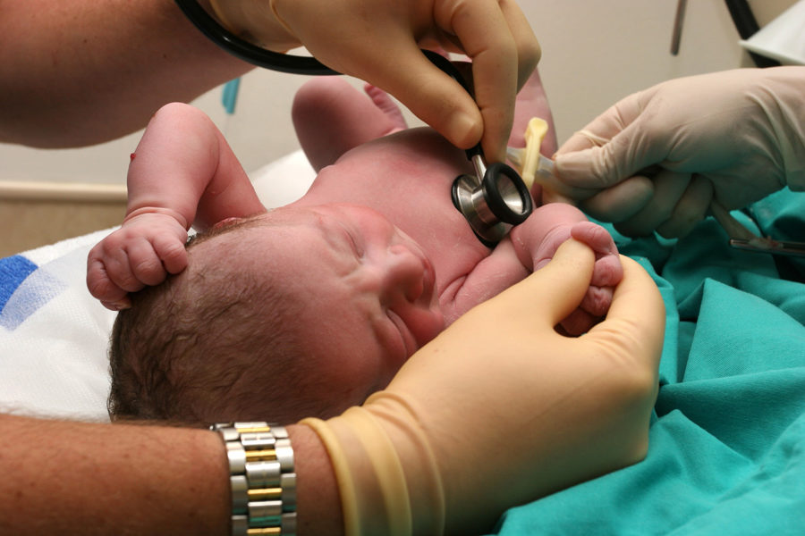 лечение асфиксии у новорожденных
