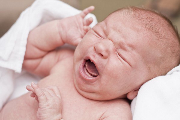 патологии у новорожденных