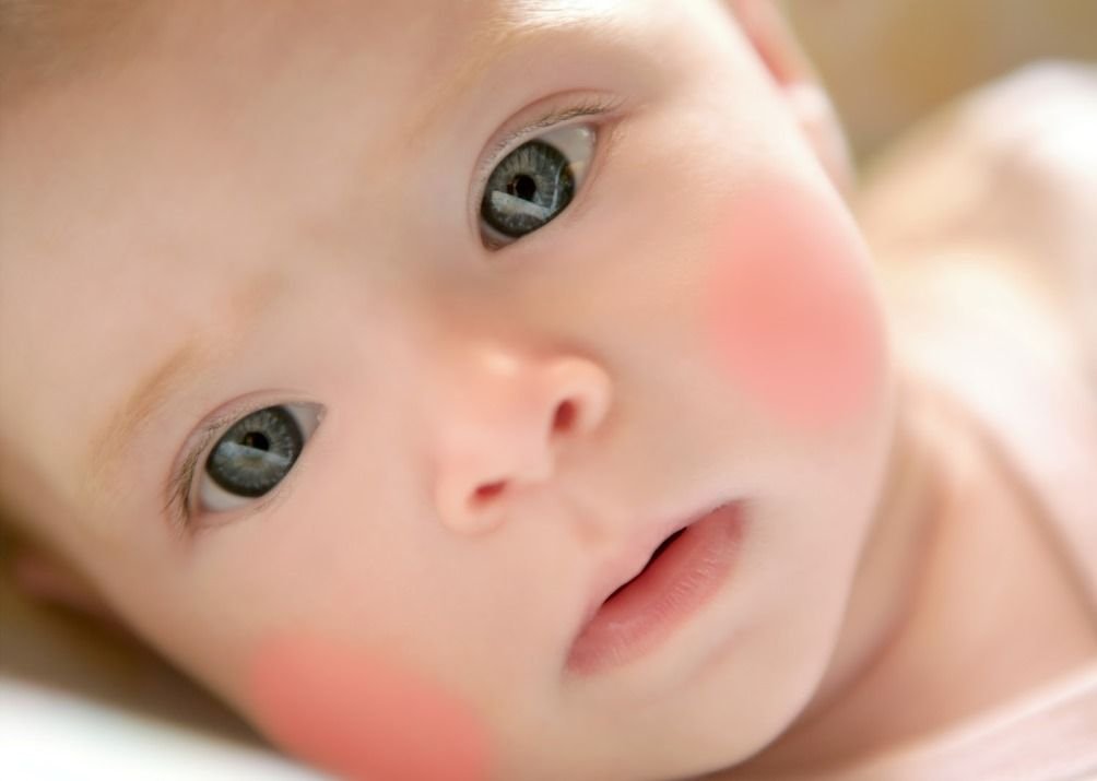 красные щечки у малыша: причины и лечение