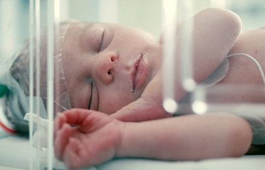 болезни новорожденных - асфиксия