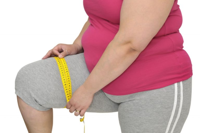 Лишний вес и ожирение