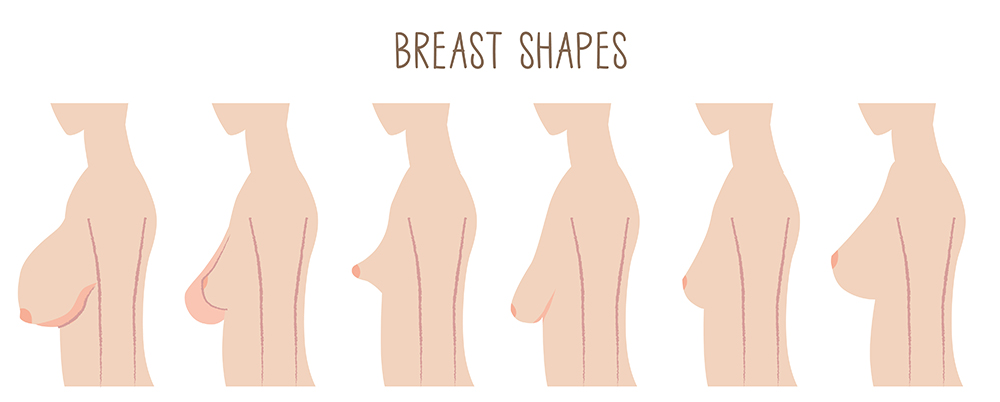 формы груди у женщин