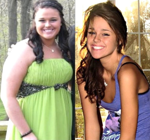 До и После похудения