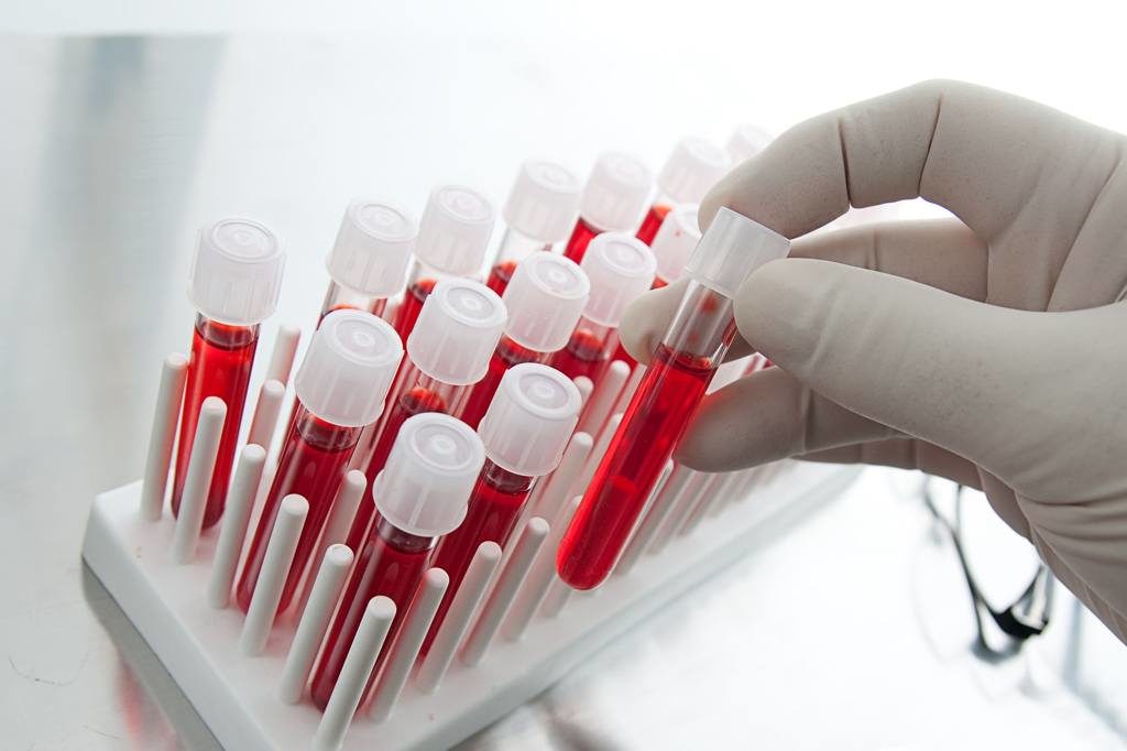 Общий и биохимический анализ крови 