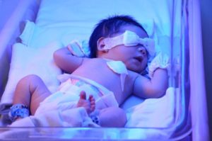 повышены билирубины у новорожденного