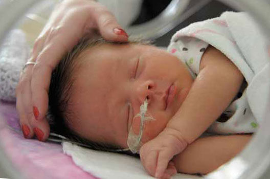 Новорожденный тяжело дышит. Асфиксия новорожденных. Асфиксия новорожденных легкой степени. Асасфиксия у новорожденного. Болезни новорожденных асфиксия.