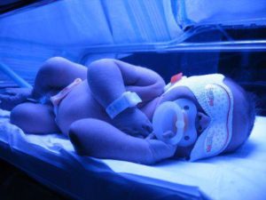 билирубин у новорожденных лечение