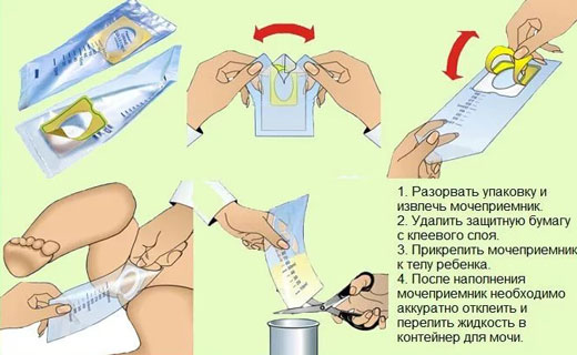 инструкция по использованию мочеприемника для грудничка